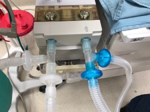 Ventilator splitters can only be used in crisis situations: Experts.